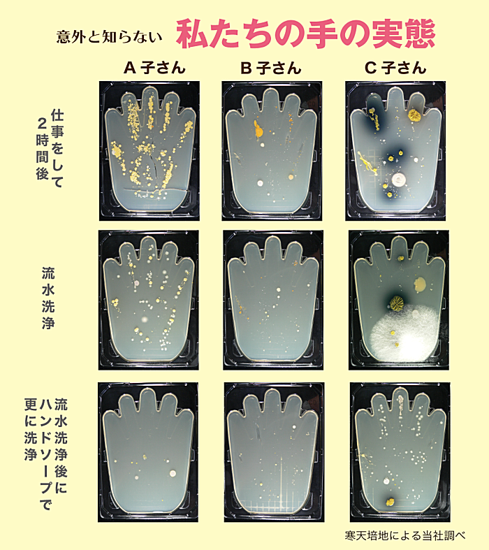指の汚れ
